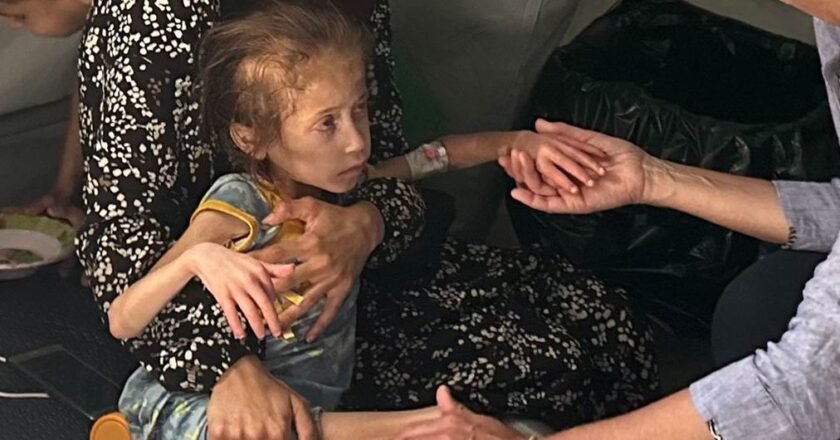 «Estan matando con hambruna», el genocidio en Gaza documentado por la ONU, ong´s y hasta por un diario israelí