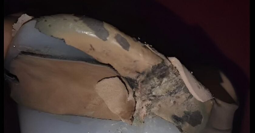 Florencio Varela: perdió su pierna en un accidente ferroviario y hoy no puede trabajar porque su prótesis está a punto de partirse