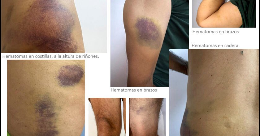 Gritos bajo el sol y marcas de fusil: El relato en primera persona del periodista argentino, Ramiro Giganti, sobre el secuestro de la Flotilla Sumud